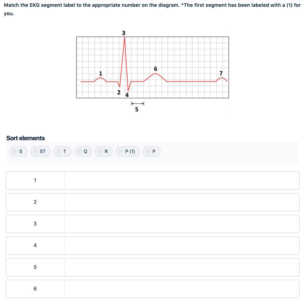 ekg practice question